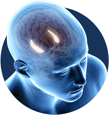 Gamma Activity inside brain